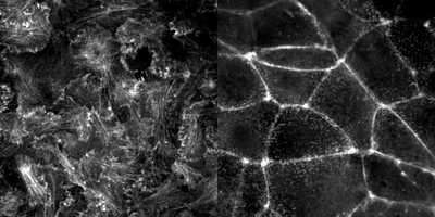Cell line media