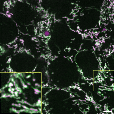 Cell line media