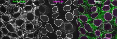 Cell line media